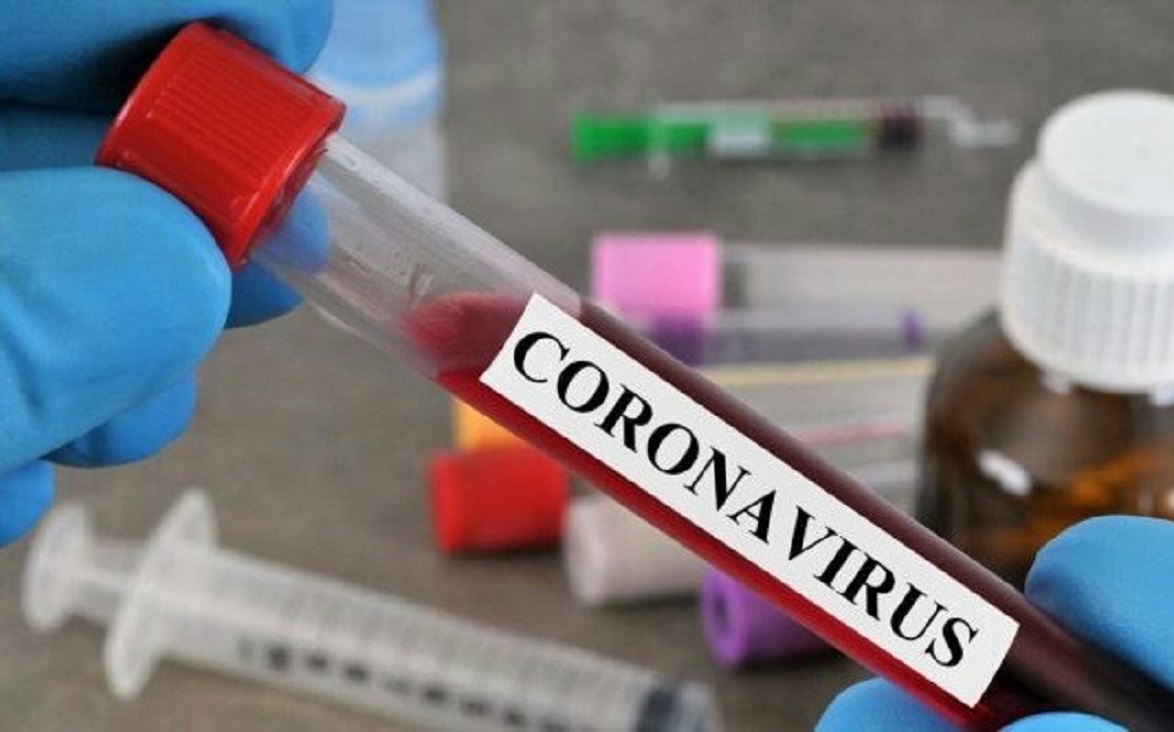 Covid-19 : 73 cas positifs sur 1877 patients dépistés au Togo