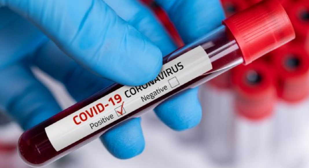 Tests massifs : Dépistage des cantons comptant déjà 10 personnes infectées